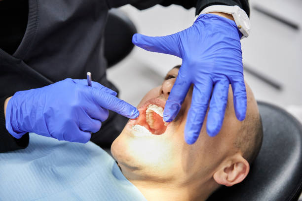 Best Dentist for Tooth Abscess  in White Castle, LA