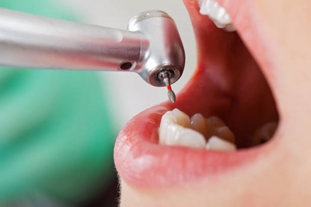 Best Knocked-Out Tooth Emergency  in White Castle, LA